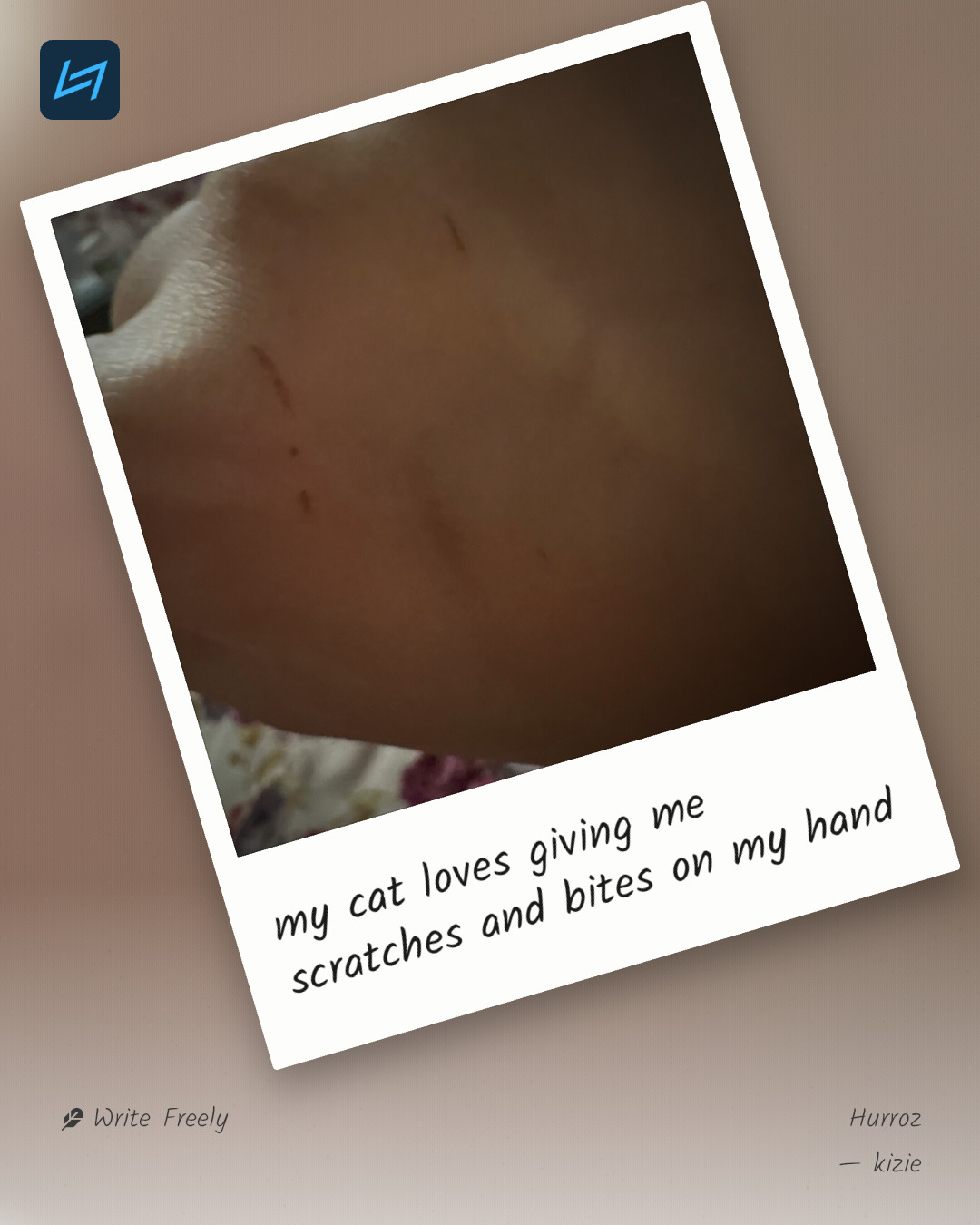 my cat loves giving me scratches and bites on my hand