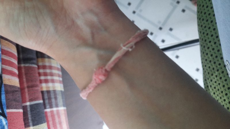 Protective threads
